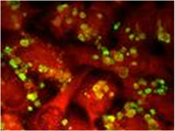 PCP - immunofluorescence in microbiology