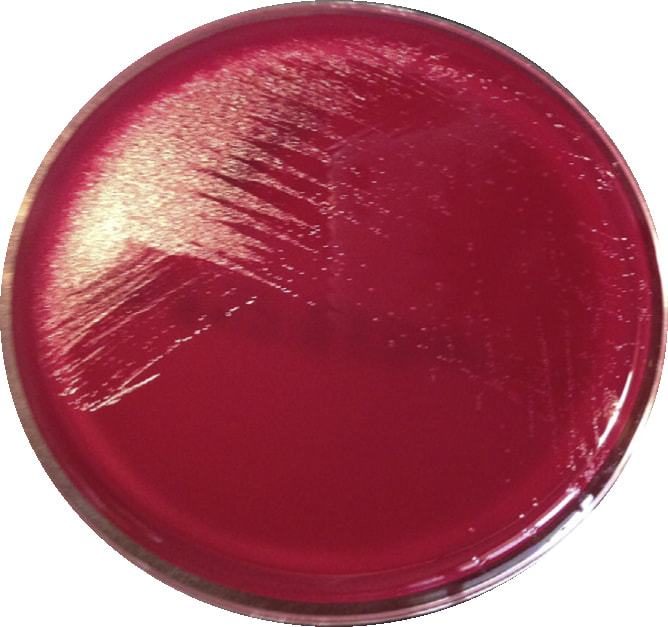 Actinotignum spp. on blood agar