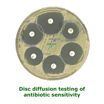 Disc diffusion testing of antibiotic sensitivity