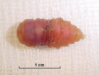 Botfly larvae