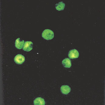 Cryptosporidium spp. auramine