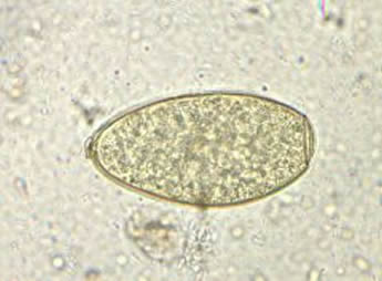fasciola hepatica egg