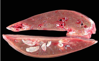 Liver flukes in liver