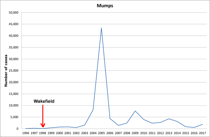 Mumps - childhood vaccination