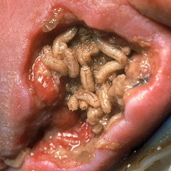 maggots carry Wohlfahrtiimonas chitiniclastica