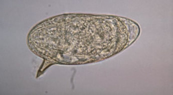 operculum schistosomiasis