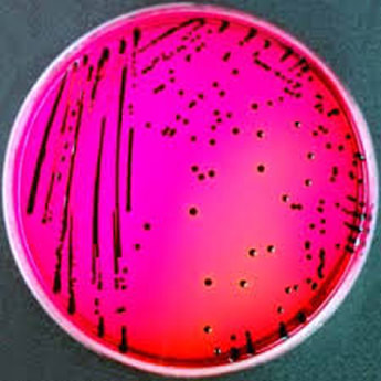Salmonella XLD pink