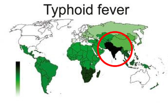 typhoid fever globally